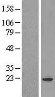 COPZ1 Human Over-expression Lysate