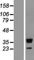 RRP15 Human Over-expression Lysate