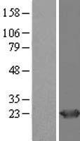 HDDC2 Human Over-expression Lysate
