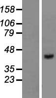 VPS36 Human Over-expression Lysate