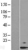 Dexras1 (RASD1) Human Over-expression Lysate
