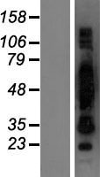Cornulin (CRNN) Human Over-expression Lysate