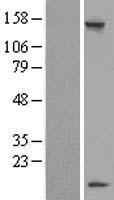 LSM7 Human Over-expression Lysate