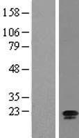 C15orf15 (RSL24D1) Human Over-expression Lysate