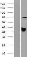 PRODH Human Over-expression Lysate