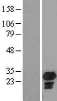 CHMP5 Human Over-expression Lysate
