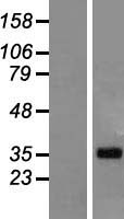 LUZP4 Human Over-expression Lysate