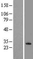 KLRF1 Human Over-expression Lysate