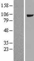 MVP Human Over-expression Lysate