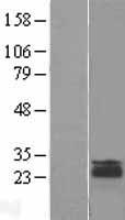 LEPROT Human Over-expression Lysate
