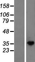 N acetylglucosamine kinase (NAGK) Human Over-expression Lysate