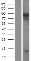 NUTM2F Human Over-expression Lysate