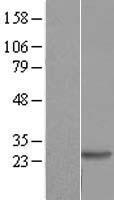 DIRAS2 Human Over-expression Lysate