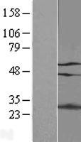 p66 alpha (GATAD2A) Human Over-expression Lysate