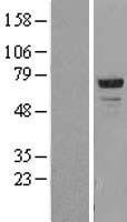 CDKN2AIP Human Over-expression Lysate