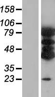 VAC14 Human Over-expression Lysate