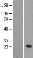 ASF1B Human Over-expression Lysate