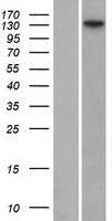 FANCI Human Over-expression Lysate
