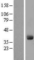 GIMAP4 Human Over-expression Lysate