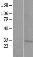 TAS2R5 Human Over-expression Lysate