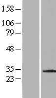 MDM1 Human Over-expression Lysate