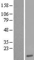 Otoraplin (OTOR) Human Over-expression Lysate