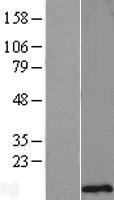 C11orf75 (SMCO4) Human Over-expression Lysate