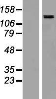 SALL4 Human Over-expression Lysate