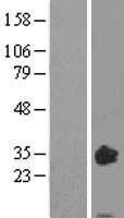 Oncostatin M (OSM) Human Over-expression Lysate