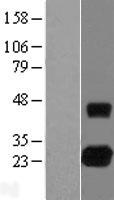 RHOJ Human Over-expression Lysate