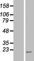 PP4R4 (PPP4R4) Human Over-expression Lysate