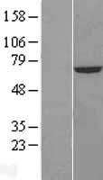 CROT Human Over-expression Lysate