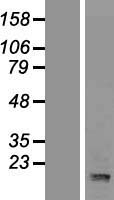 POLD4 Human Over-expression Lysate