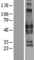 GPBP1L1 Human Over-expression Lysate
