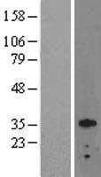 OTX2 Human Over-expression Lysate