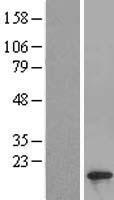 SIVA (SIVA1) Human Over-expression Lysate