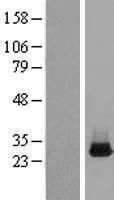 STEEP1 Human Over-expression Lysate