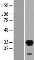 LHPP Human Over-expression Lysate