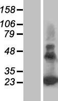 PERP Human Over-expression Lysate