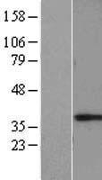 MAGEF1 Human Over-expression Lysate
