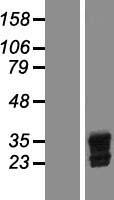 Livin (BIRC7) Human Over-expression Lysate