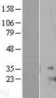 IL17E (IL25) Human Over-expression Lysate