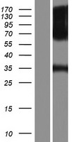 FGFR1 Human Over-expression Lysate