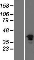 FGFR1 Human Over-expression Lysate