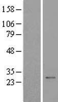 UBE2Z Human Over-expression Lysate