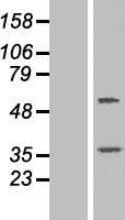 TTC23 Human Over-expression Lysate