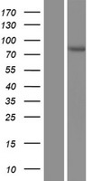 Acetoacetyl CoA synthetase (AACS) Human Over-expression Lysate