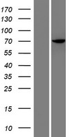 HROB Human Over-expression Lysate