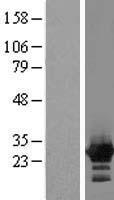 ZFYVE21 Human Over-expression Lysate