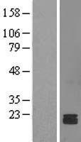NDUFS7 Human Over-expression Lysate